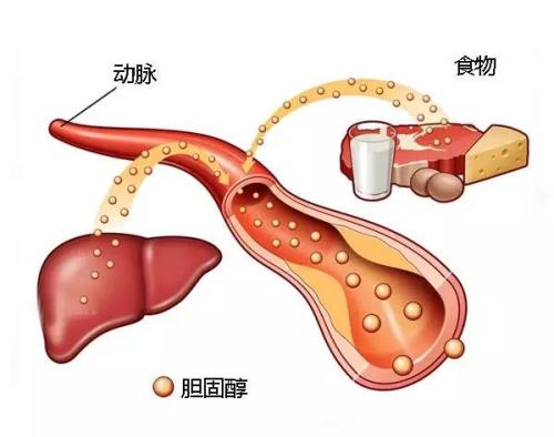 可以打针降低胆固醇吗？